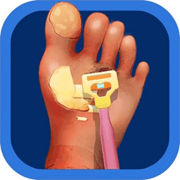 老板修个脚甲沟炎游戏 v1.6.4